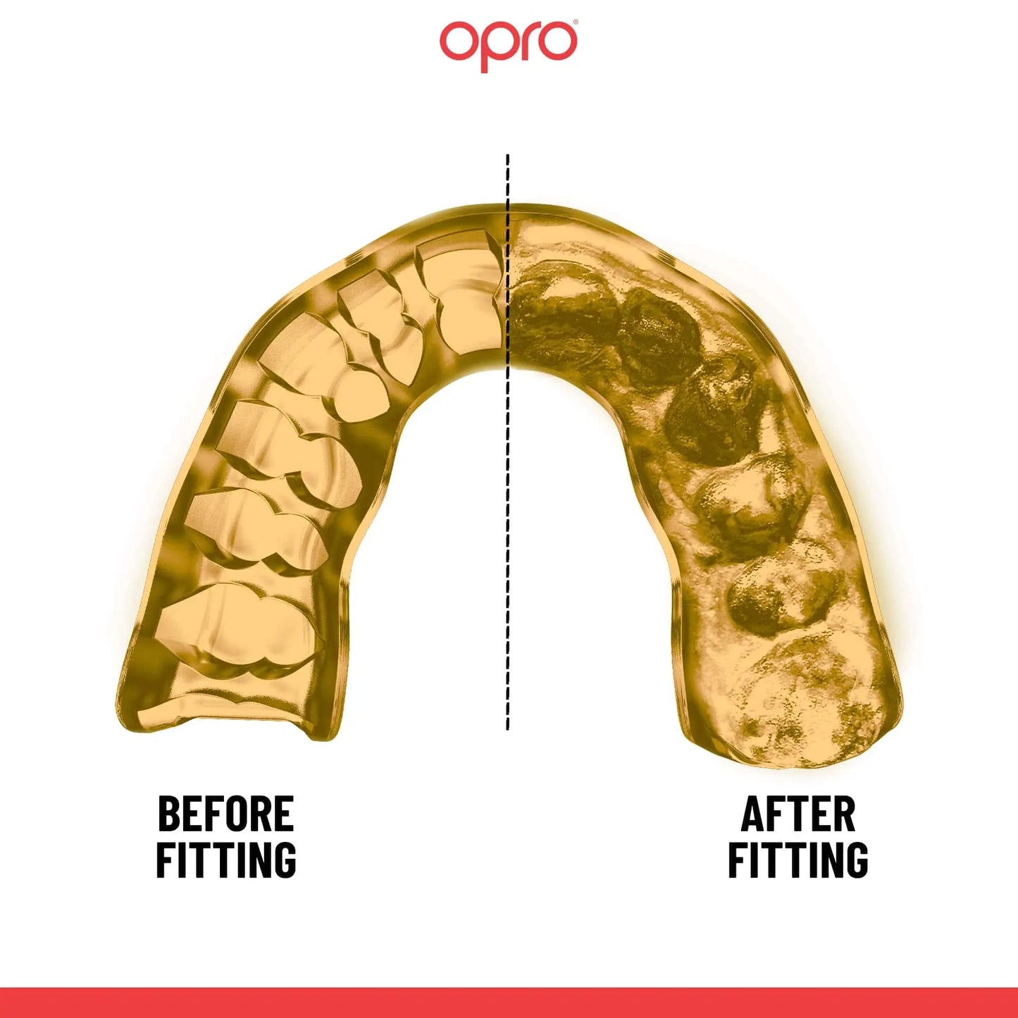 OPRO Instant Custom-Fit Sports Mouth Guard, Revolutionary Fitting Technology for Ultimate Comfort, Protection & Fit, Gum Shield, Dentist Mouthguard for Rugby, Boxing, Hockey, MMA (Gold Teeth, Adult) The Champ Gear