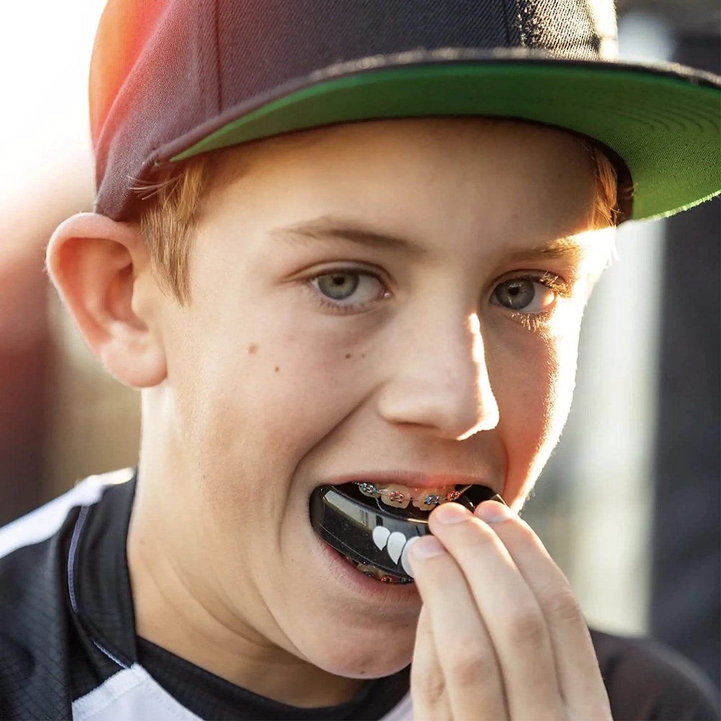 Shock Doctor Mouth Guard for Braces for Sports, Orthodontic Mouth Guard for Braces, Upper & Lower Mouthguard, Mouth Guard for Lacrosse, Hockey, Baseball, Football, Braces Mouth Guard The Champ Gear