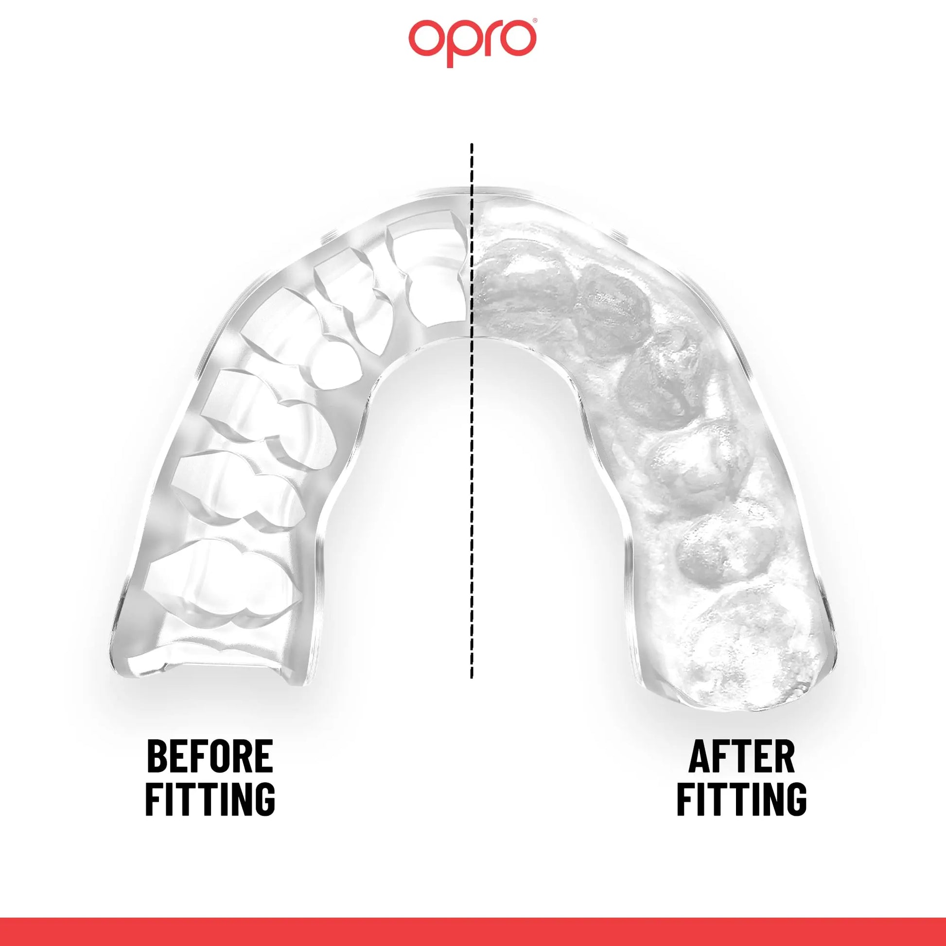 OPRO Instant Custom-Fit Sports Mouth Guard, Revolutionary Fitting Technology for Ultimate Comfort, Protection & Fit, Gum Shield, Dentist Mouthguard for Rugby, Boxing, Hockey, MMA (Gold Teeth, Adult) The Champ Gear