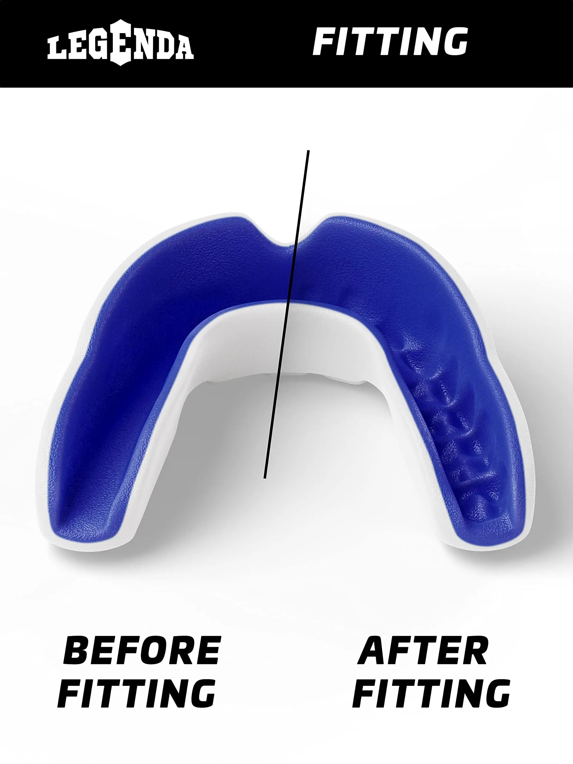 Legenda Sports Mouthguard for Kids (w/Case), Professional Mouthguard for Boxing, MMA, Karate, Football, BJJ, Martial Arts, Rugby, Lacrosse, Hockey (White/Blue) The Champ Gear